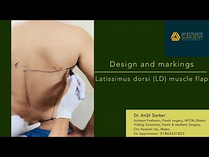 Latissimus dorsi( LD) muscle flap: Markings and Designs