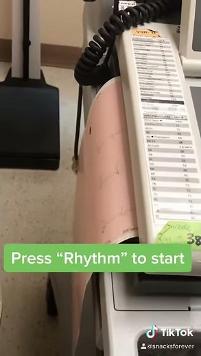 ECG 7: How to run a continuous Rhythm Strip