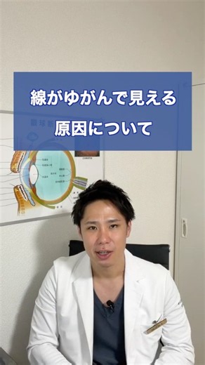 線がゆがんで見える原因について