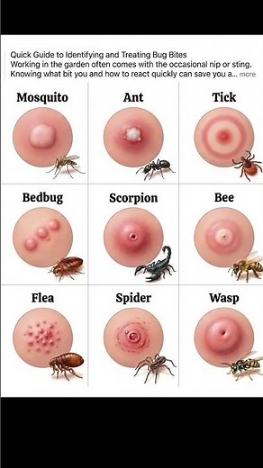 Bug Bite Identification Guide | Mosquito, Spider, Bee, Bedbug Bites Explained#viral #trending