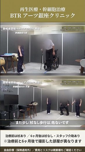 Cervical Disc Herniation: 50s Male | Gait Test: Before Treatment vs. 6 Months After [BTR Arts Gin...