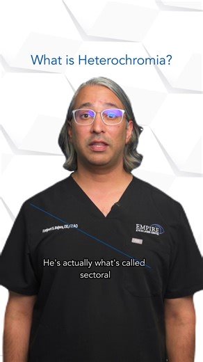 Heterochromia: Benedict Cumberbatch's Fascinating Eyes