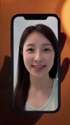 Facial Fat Transfer before & after