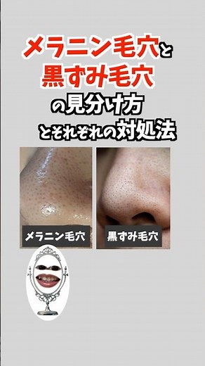 メラニン毛穴と黒ずみ毛穴の見分け方 それぞれの対処法