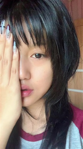 Recovering from Wisdom Tooth Extraction: My Experience