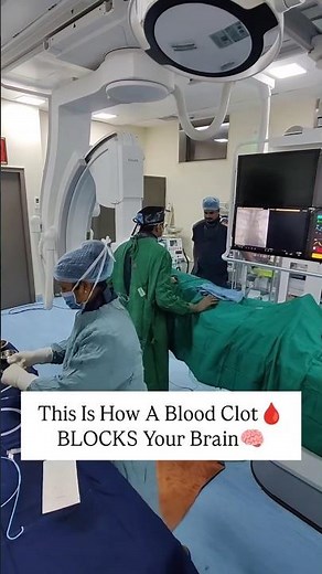 How a Blood Clot Blocks Your Brain | Stroke Explained by a Neurosurgeon 🧠⚠️