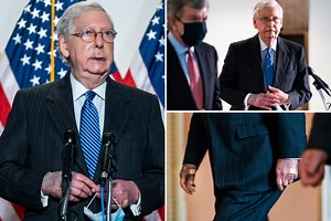 McConnell's discolored hands 'may be blood LEAKING from vessels', doc says