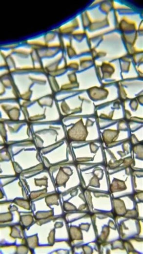 Onion skin cells under microscope