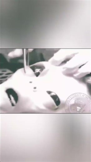 Grey Alien Autopsy Video: Real or Fake? 👽