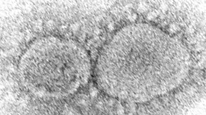 More than half of US states reporting 'very high' COVID activity levels: CDC