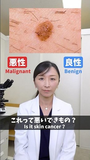 【皮膚科医が解説】このできもの、悪いもの？