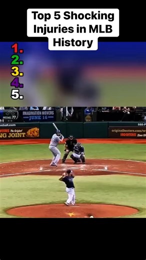225K views · 729 reactions | Top 5 Shocking Injuries in MLB History #mlbbhighlights #baseball #MLB #baseballlife #baseballlifestyle | Deportecomedia | Facebook