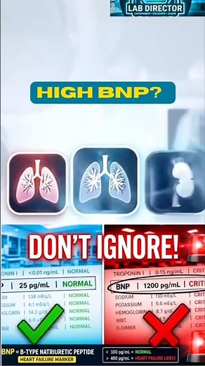 Heart Squeeze: What High BNP Means!