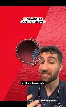 POV: You Have an Anterior Placenta