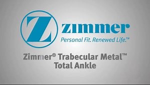Zimmer® Trabecular Metal™ Total Ankle- Patient Testimonial-Diane Briggs