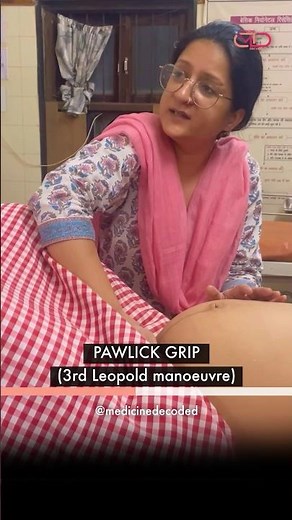 PAWLICK GRIP (3rd Leopold manoeuvre) @medicynedecoded. #laborroom #clinicalpractice