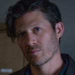 'Criminal Minds' Star Zach Gilford Shares Shocking Photos of Face After Health Scare