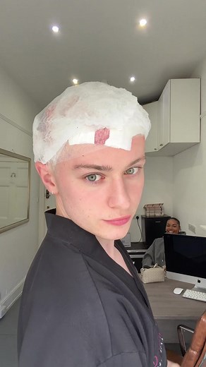 Hair transplant with Ben Cameron: patient highlights