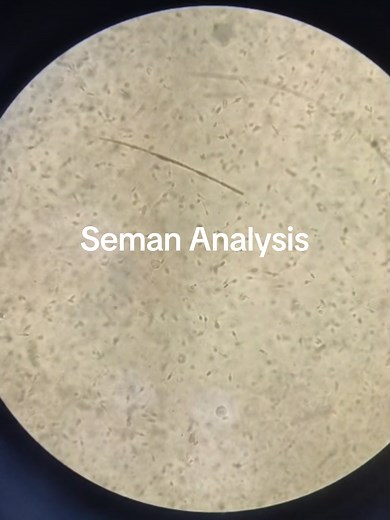 #foryou #viralvideo #fyp #foryoupage #pathalogist