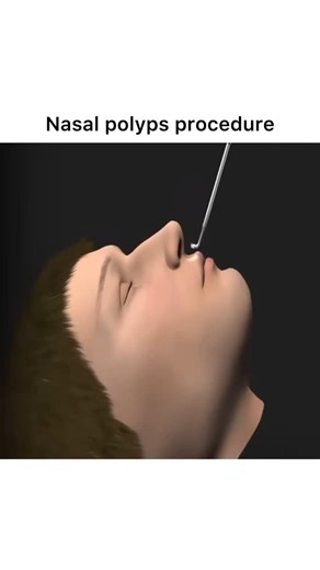 Animations | Follow @surgicalanimation for more! 🏥 | Instagram