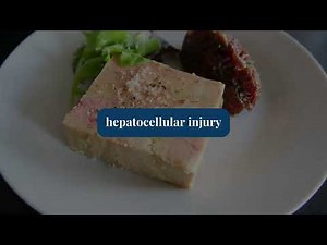 How to Investigate Elevated Liver Function Tests LFTs Diagnosis and Treatment