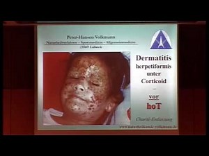 Allergie, Reizdarm bis chronischer Schmerz: Ganzheitliche Lösung komplizierter Krankheitssyndrome