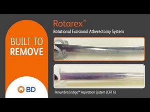 Rotarex side by side Penumbra