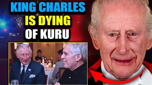 King Charles 'Dying of Kuru' After Decades of Child Meat BanquetsKing Charles is running out of time. His swollen sausage fingers are reaching their limit, and according to whistleblowers deep inside the palace, the monarch has been diagnosed with kuru - the ruthless prion disease triggered by consuming infected human brain tissue.As his highly redacted links to Jeffrey Epstein detonate in the open, the walls are closing in. This is the reckoning the Firm has dreaded for decades.