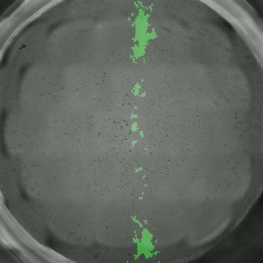 In Vitro Wound Healing Assay with Keratinocytes | Scratch Assay