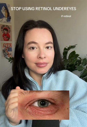 Switch to Gentle Eye Treatments for Sensitive Skin