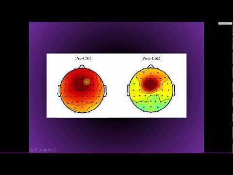 Surface Laplacian for cleaning, topoplogical localization, and connectivity