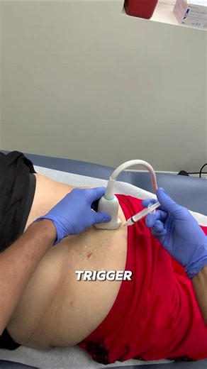 How to alleviate back pain? Trigger point injections are different from injections that target the spine or joints. 💉 The needle goes directly into a tight, irritated area of muscle that may be contributing to back pain. The goal is to reduce muscle tension and make movement more comfortable. Then use that relief to move, strengthen, and work on recovery. #backpain #painmanagement #painrelief