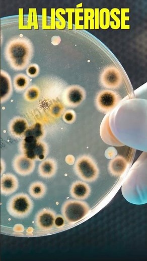 What are the effects of listeriosis on your health?