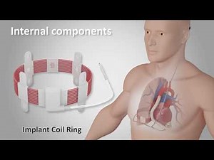 Leviticus Cardio - Fully Implanted VAD