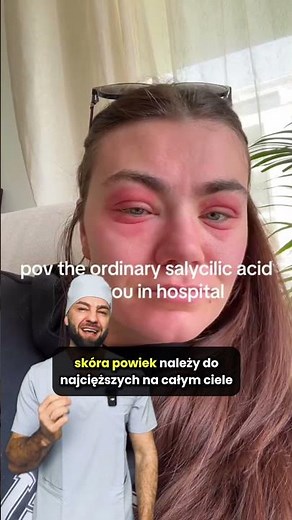 Jak dbać o skórę wokół oczu? Sposoby na młody wygląd