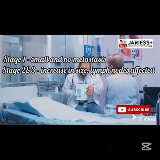 What Are The Stages of Cancer?