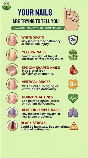 Your Nails Can Reveal Hidden Health Problems – 7 Signs You Should Know | Dr. ZT's Health Tips