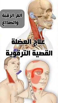 علاج ألم دوران الرقبة وصداع الجبهة وخلف العين و الصداع النصفي #Sternocleidomastoid