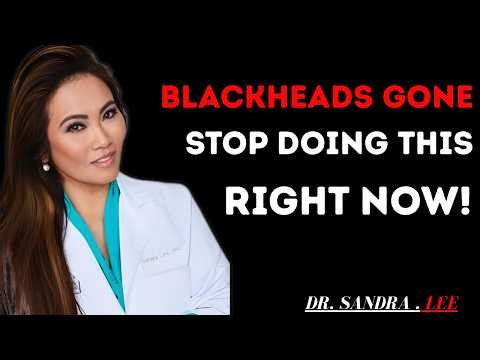 Stop Doing This If You Have Blackheads(You Are Making Them Worse) | Dr. Sandra Lee