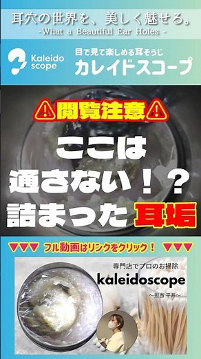 【閲覧注意】ここは通さない！？詰まった耳垢