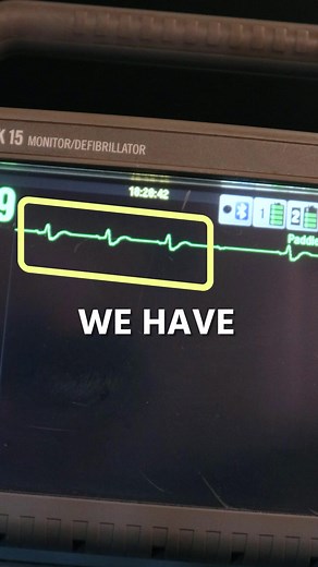 The PR Interval is the key to all your heart block rhythms. #ekg #paramedicschool #nremt