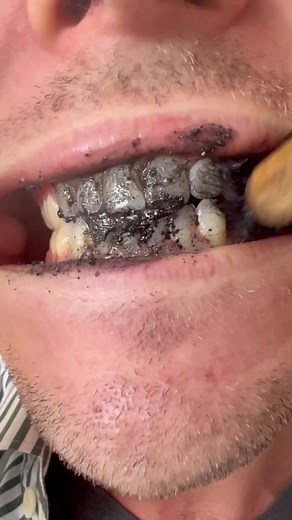 Whiter Teeth in 60 Seconds: Charcoal Tooth Tabs Review