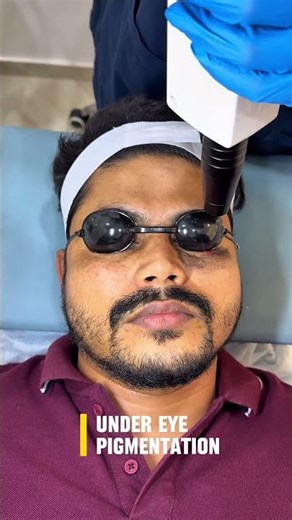 Under Eye Treatment