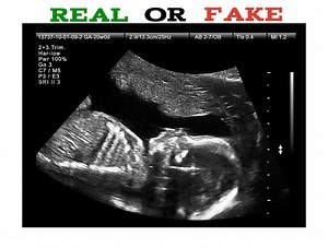 How to Spot Fake Ultrasound Picture - Public Health