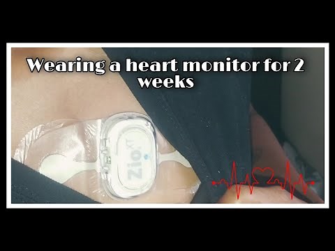 Wearing a Zio heart monitor for 2 WEEKS