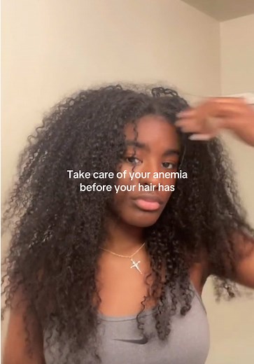 Hair Growth Update After Iron Deficiency Anemia — What Changed