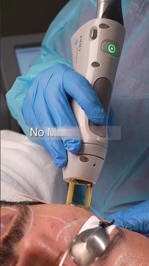 Laser Beard Shaping for Men | Permanent Beard Line Definition & Grooming