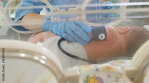 Closeup shot of doctor hands setting medical sensors to infant in infant incubator. doctor of intensive therapy attaches premature baby to incubator, preparing for transportation of newborn. 4k