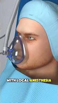 How Prostate Artery Embolization Is Performed (3D Animation) #urology #medicaleducation #healthcare