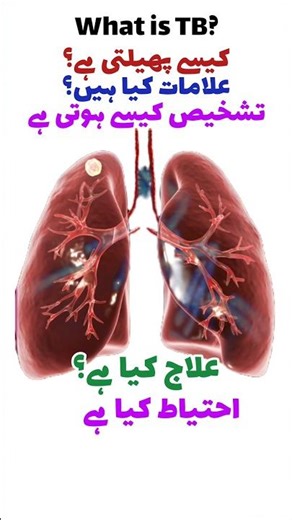 Tuberculosis, diagnosis, symptoms, causes and treatment